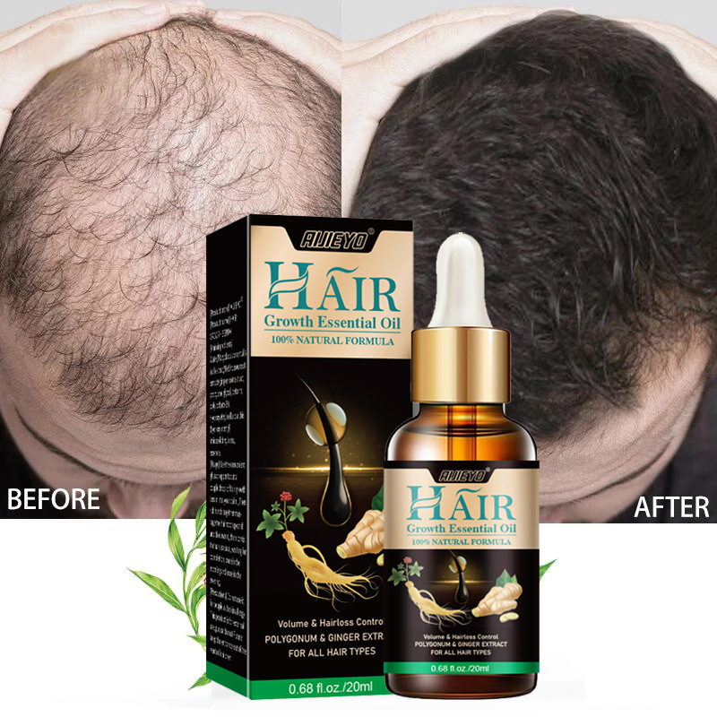 2023 Biotin Fast Hair Growth O - Licorice Root Sticks のレビューと価格