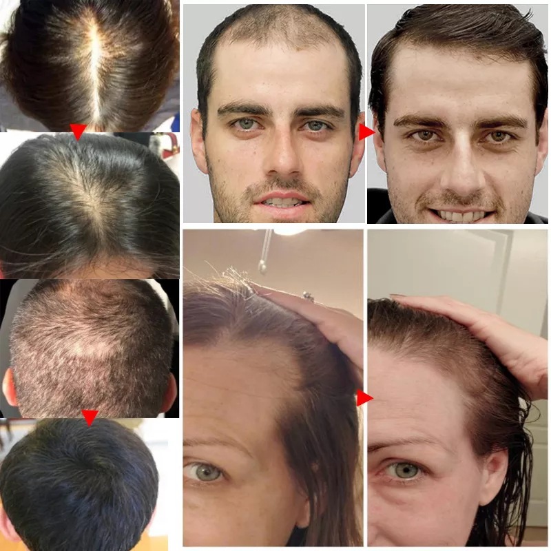 2023 Biotin Fast Hair Growth O - Licorice Root Sticks のレビューと価格