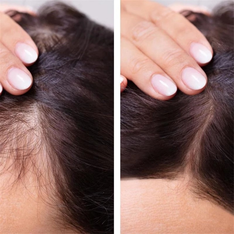 2023 Biotin Fast Hair Growth O - Licorice Root Sticks のレビューと価格