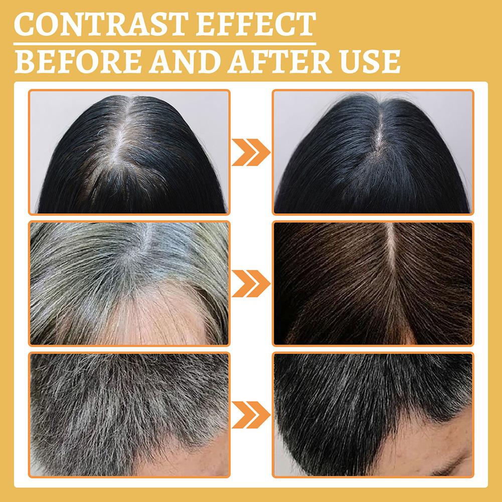 10xGrey Hair Reverse Serums Ga - Licorice Root Sticks のレビューと価格